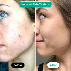 Glow Skincare Wand - Main Product Image 7