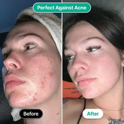 Glow Skincare Wand - Main Product Image 6