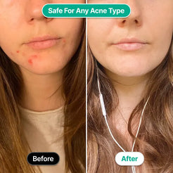 Glow Skincare Wand - Main Product Image 8